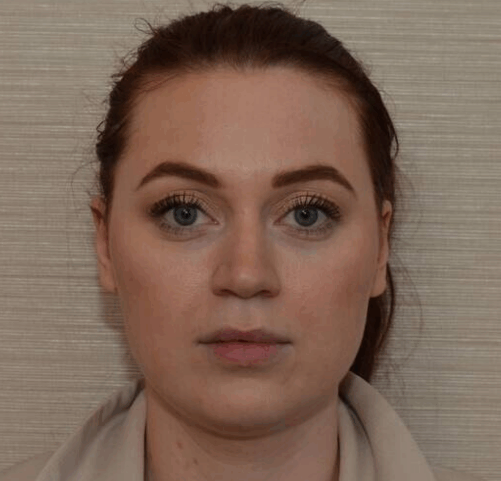 Facial slimming voor