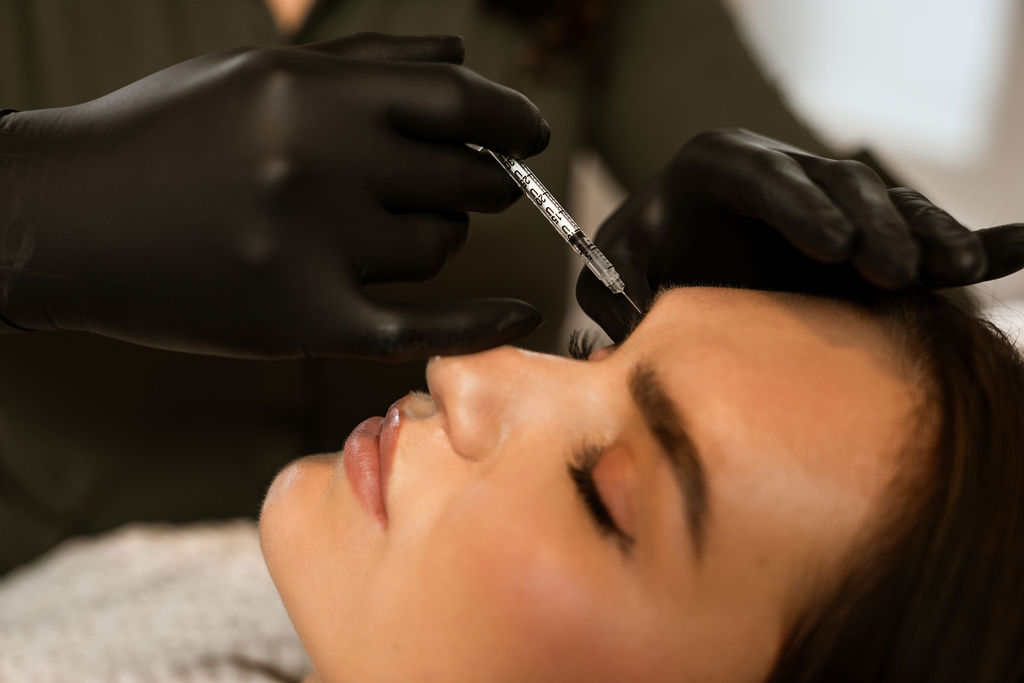 Botox behandeling frons