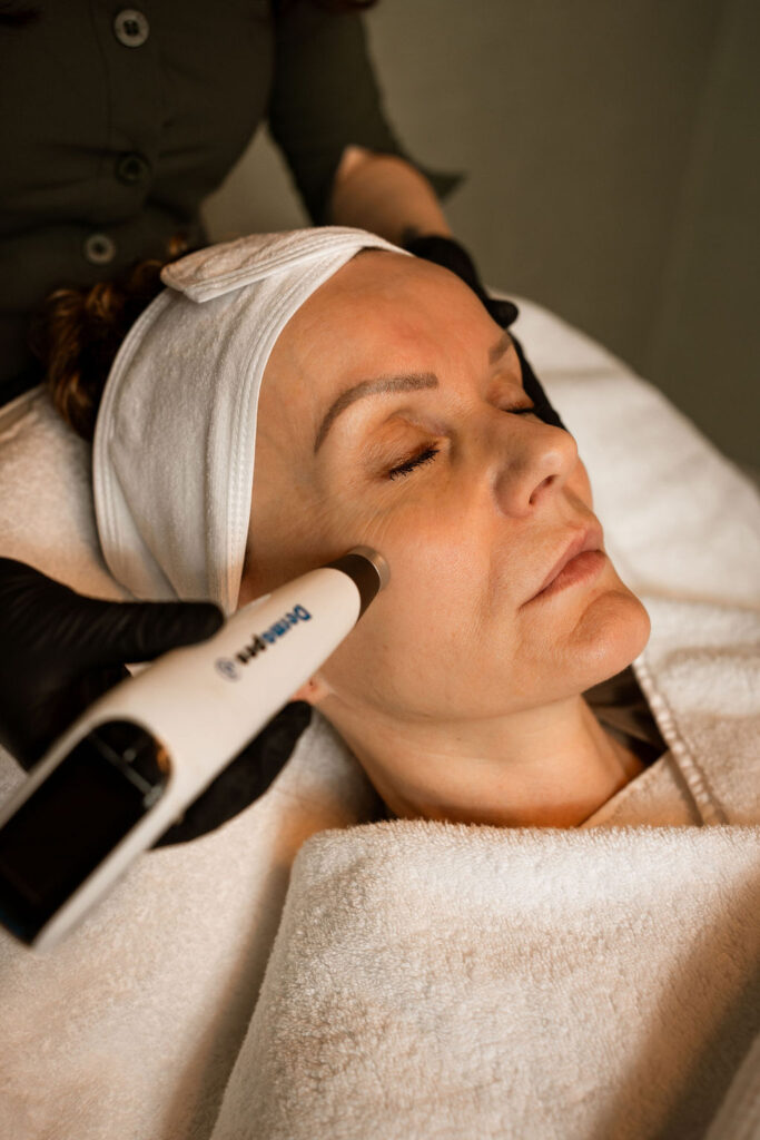 Dermapen Microneedling