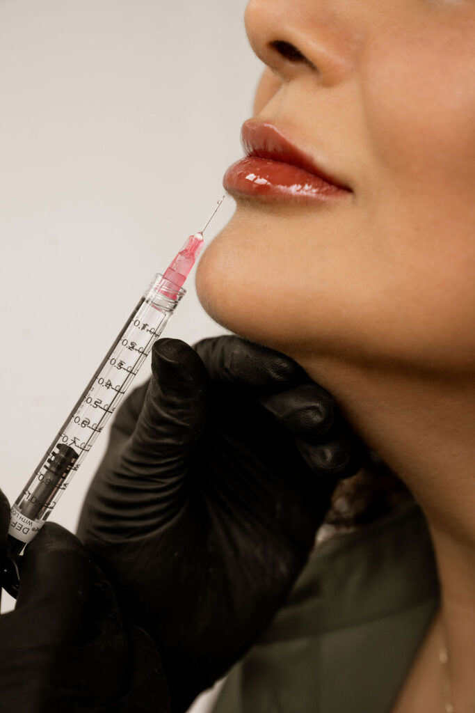 lipfillers
